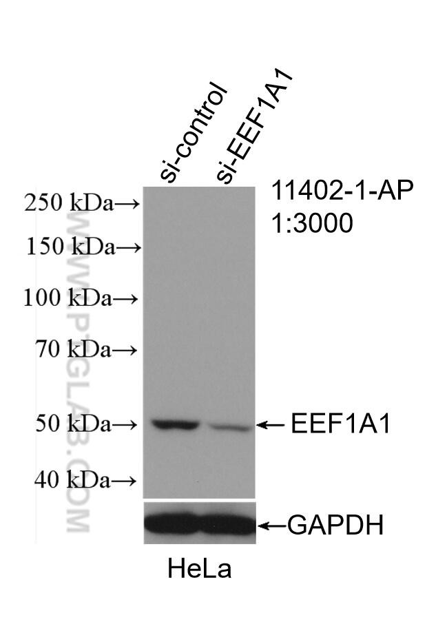 EEF1A1 Antibody in Western Blot (WB)