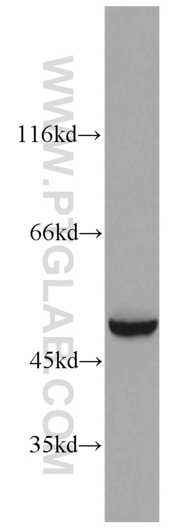 EEF1A1 Antibody in Western Blot (WB)