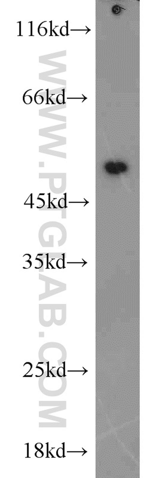 EEF1A1 Antibody in Western Blot (WB)