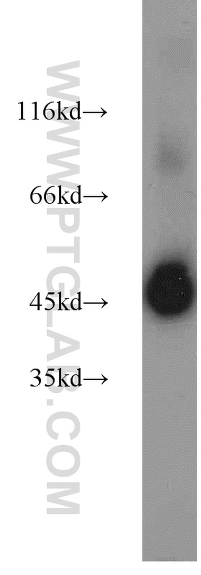 EEF1A1 Antibody in Western Blot (WB)