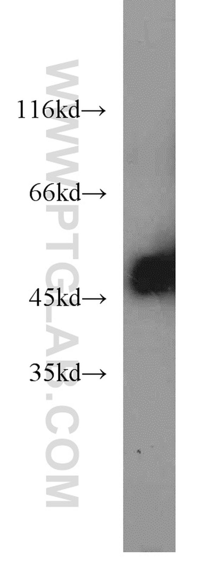 EEF1A1 Antibody in Western Blot (WB)