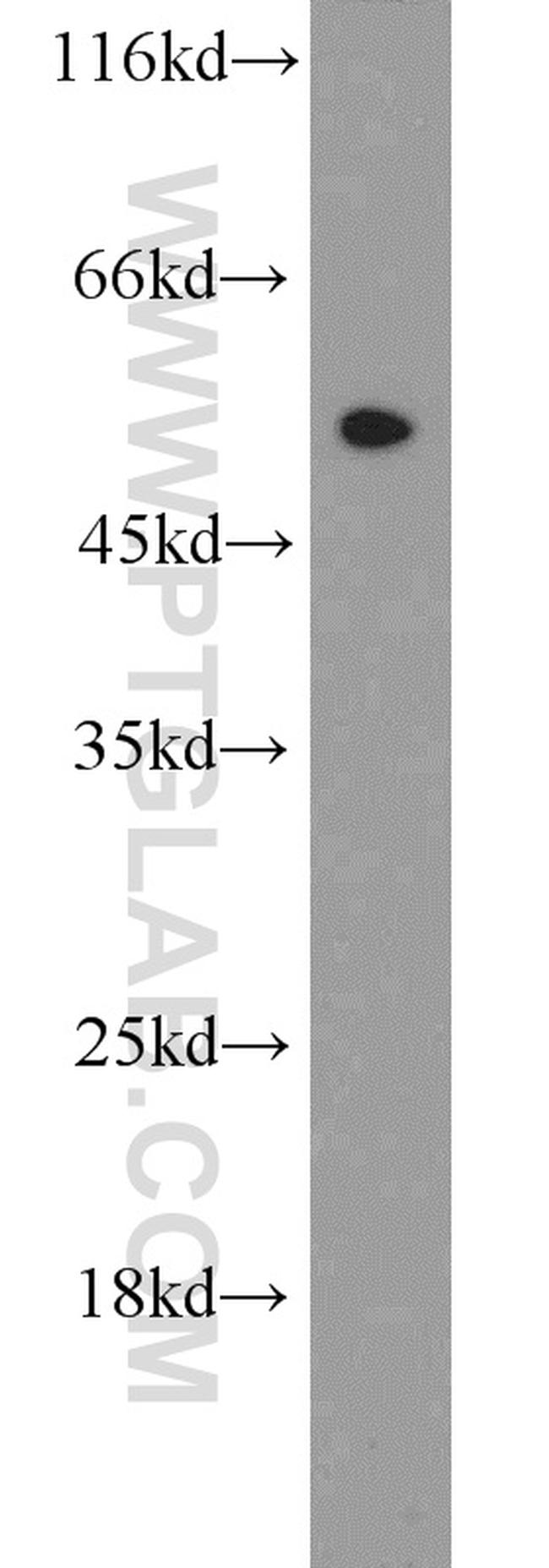 EEF1A1 Antibody in Western Blot (WB)