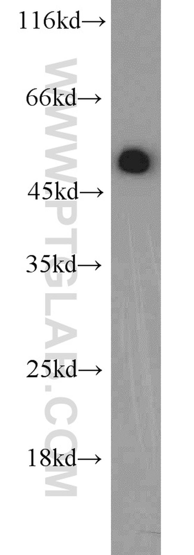 EEF1A1 Antibody in Western Blot (WB)