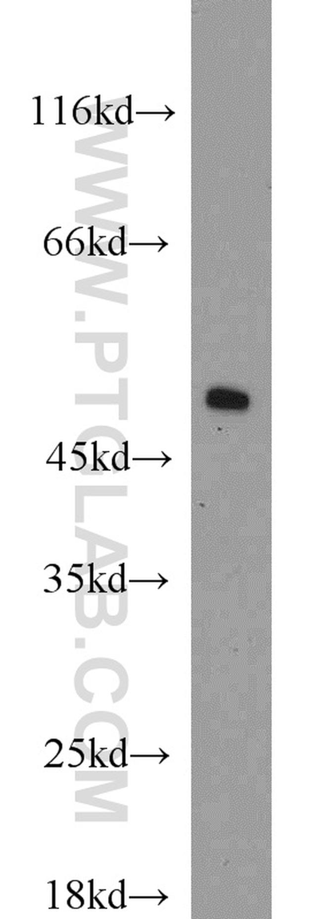 EEF1A1 Antibody in Western Blot (WB)