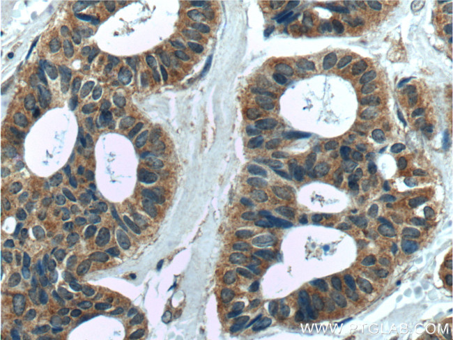 MELK Antibody in Immunohistochemistry (Paraffin) (IHC (P))