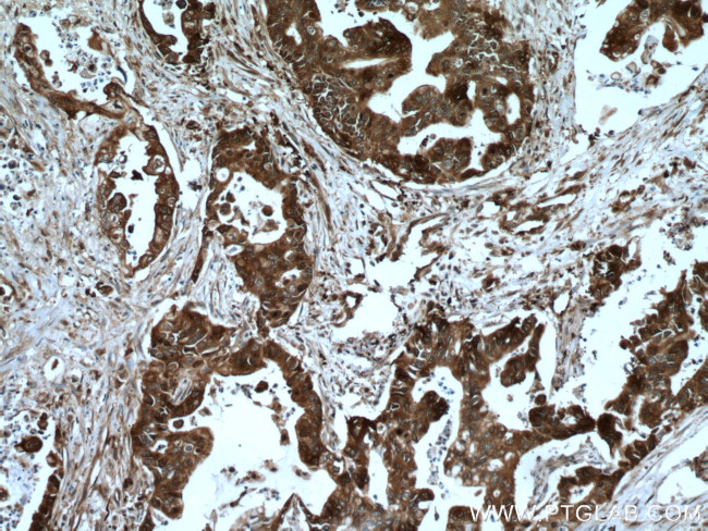 HSP90AB1 Antibody in Immunohistochemistry (Paraffin) (IHC (P))