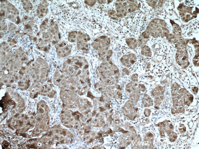 HSP90AB1 Antibody in Immunohistochemistry (Paraffin) (IHC (P))