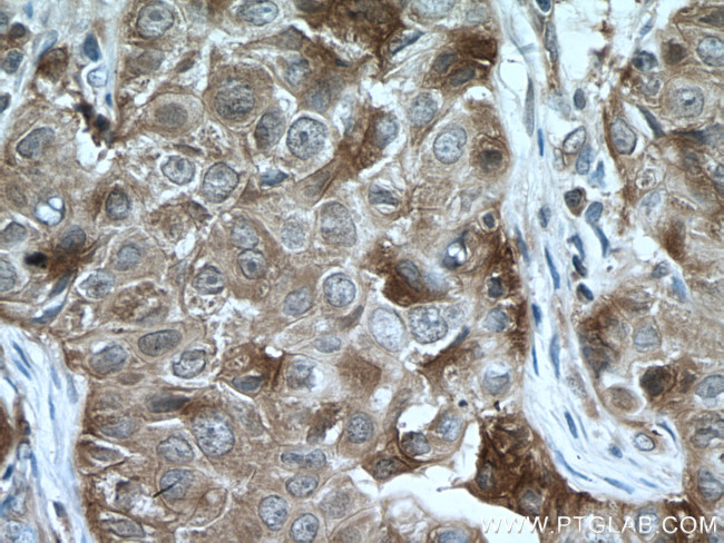 HSP90AB1 Antibody in Immunohistochemistry (Paraffin) (IHC (P))