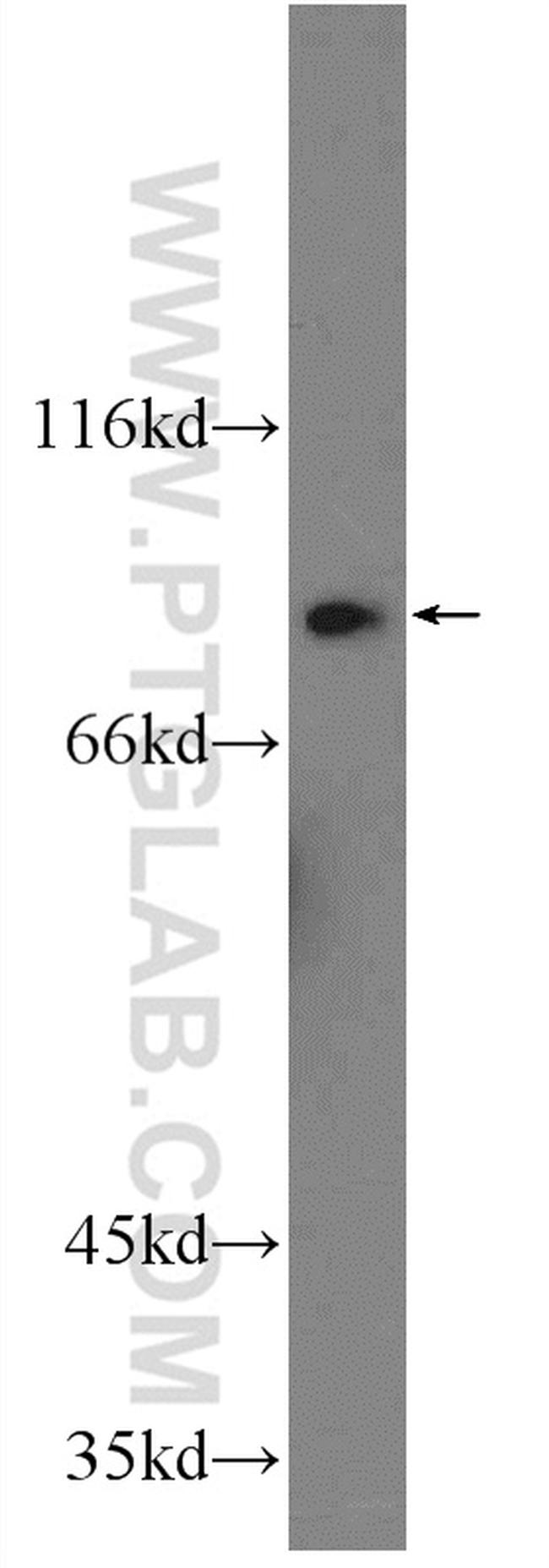 HSP90AB1 Antibody in Western Blot (WB)