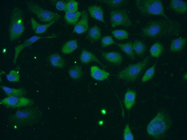 TACC2 Antibody in Immunocytochemistry (ICC/IF)