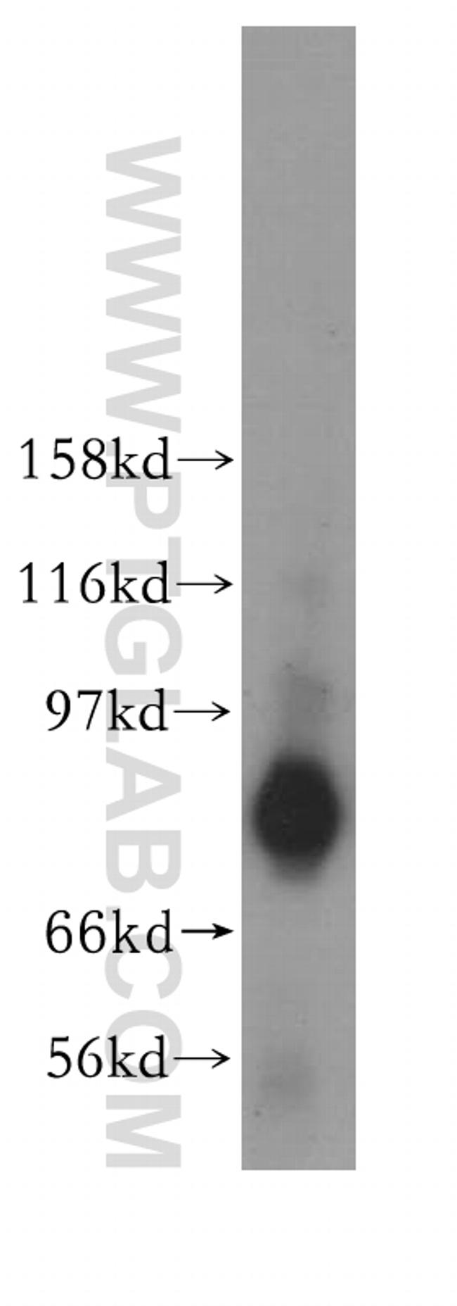 TACC2 Antibody in Western Blot (WB)