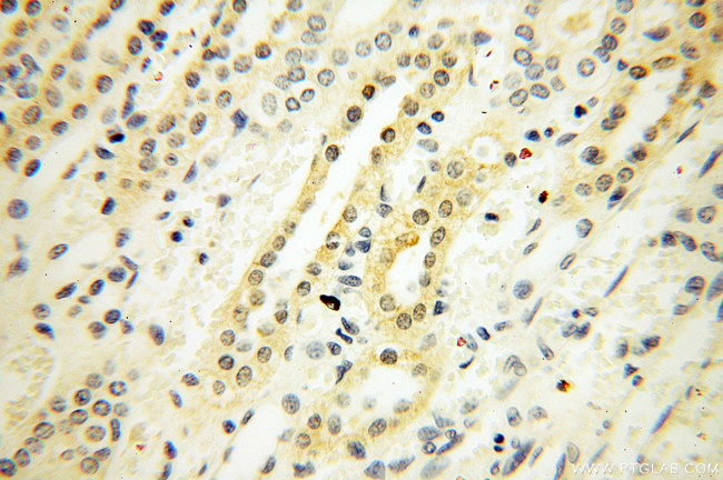 XPO6 Antibody in Immunohistochemistry (Paraffin) (IHC (P))