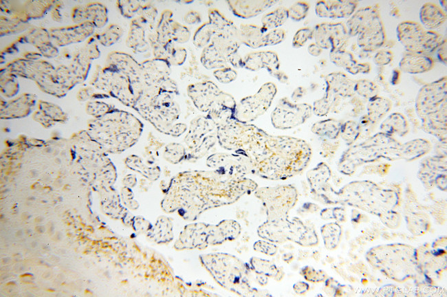 XPO6 Antibody in Immunohistochemistry (Paraffin) (IHC (P))