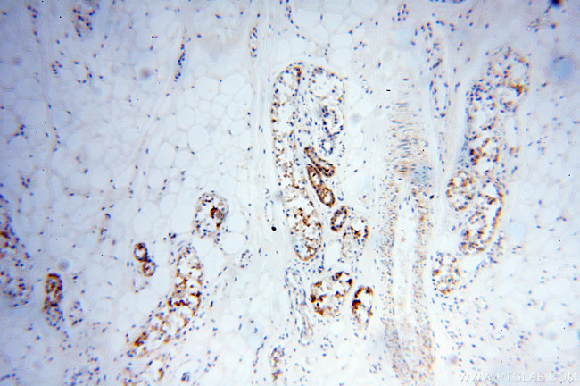 XPO6 Antibody in Immunohistochemistry (Paraffin) (IHC (P))