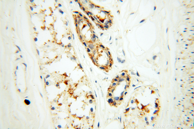 XPO6 Antibody in Immunohistochemistry (Paraffin) (IHC (P))