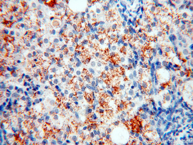 XPO6 Antibody in Immunohistochemistry (Paraffin) (IHC (P))