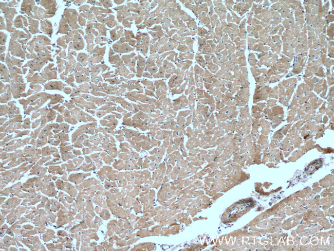 XPO6 Antibody in Immunohistochemistry (Paraffin) (IHC (P))