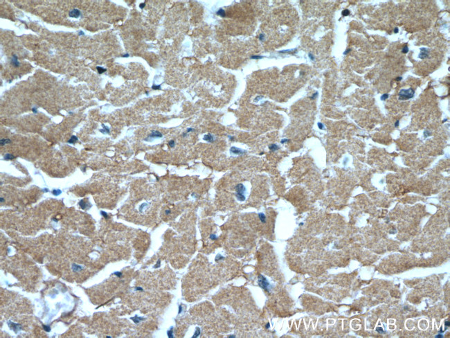 XPO6 Antibody in Immunohistochemistry (Paraffin) (IHC (P))