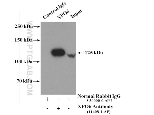 XPO6 Antibody in Immunoprecipitation (IP)