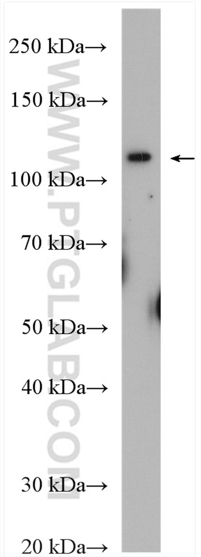 XPO6 Antibody in Western Blot (WB)