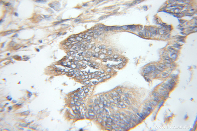 PSMD12 Antibody in Immunohistochemistry (Paraffin) (IHC (P))