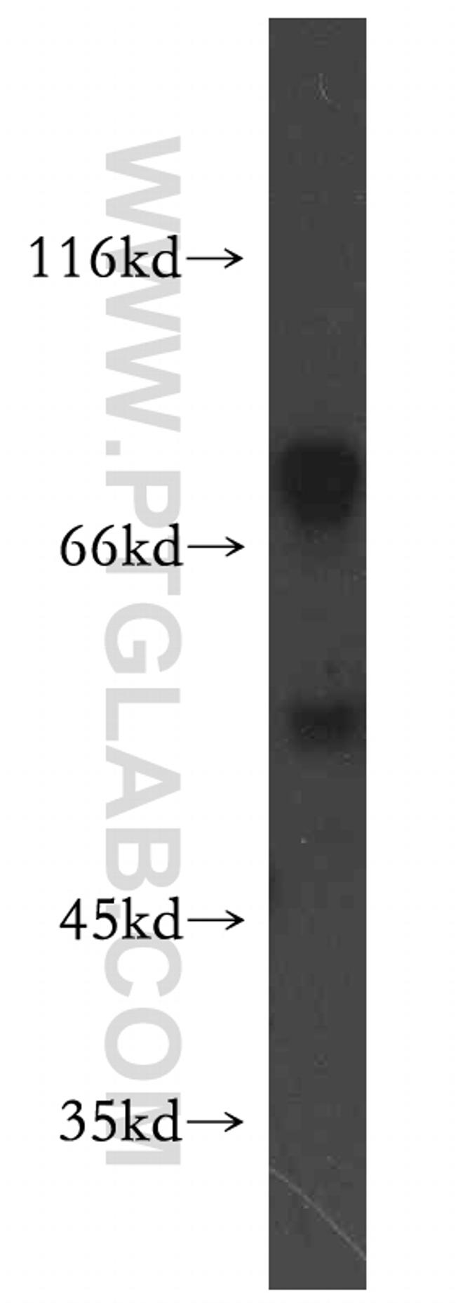 PSMD12 Antibody in Western Blot (WB)