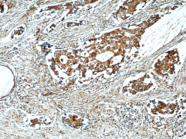 COX7A2L Antibody in Immunohistochemistry (Paraffin) (IHC (P))