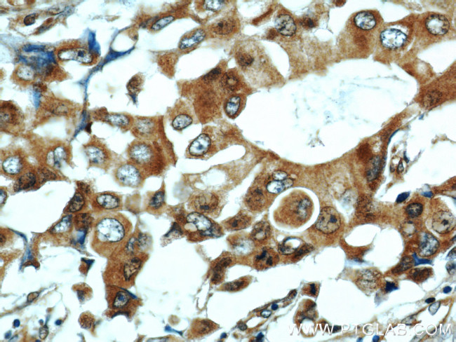 COX7A2L Antibody in Immunohistochemistry (Paraffin) (IHC (P))