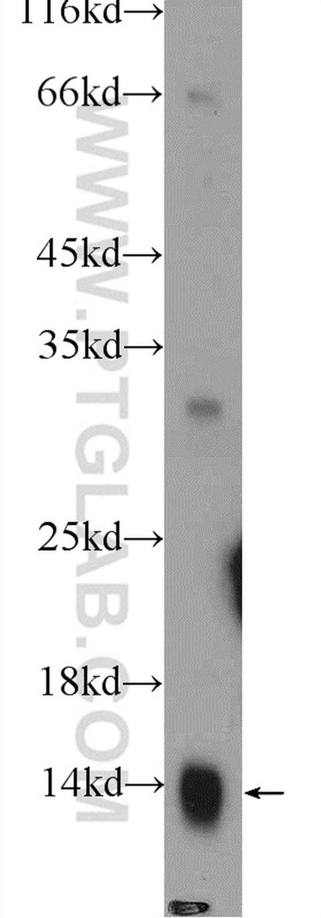 COX7A2L Antibody in Western Blot (WB)