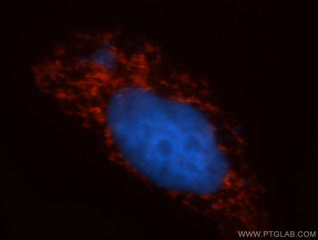 COX5B Antibody in Immunocytochemistry (ICC/IF)