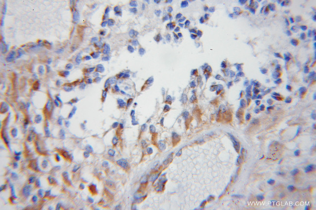 COX5B Antibody in Immunohistochemistry (Paraffin) (IHC (P))