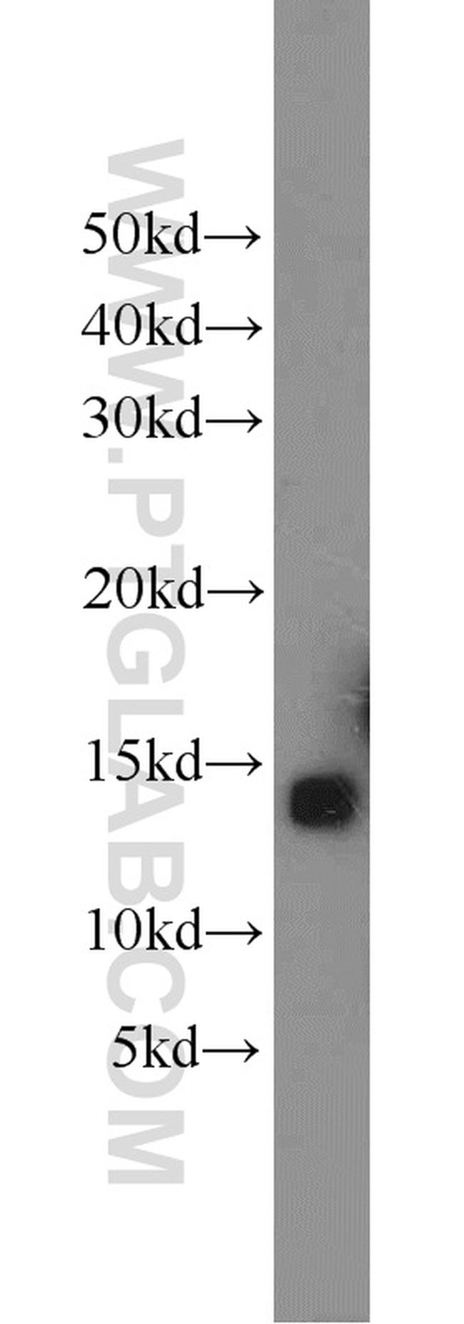 COX5B Antibody in Western Blot (WB)