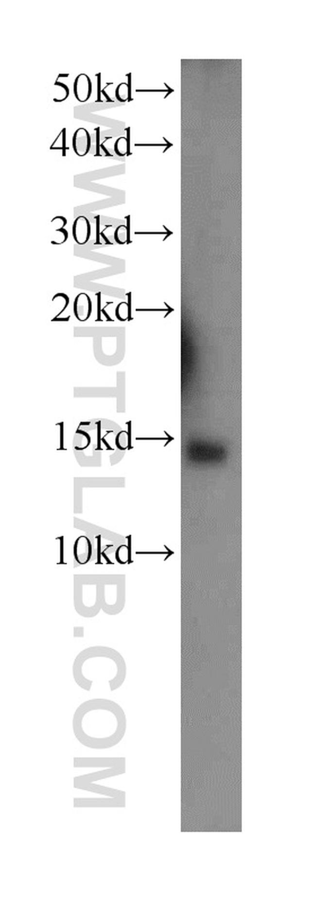 COX5B Antibody in Western Blot (WB)