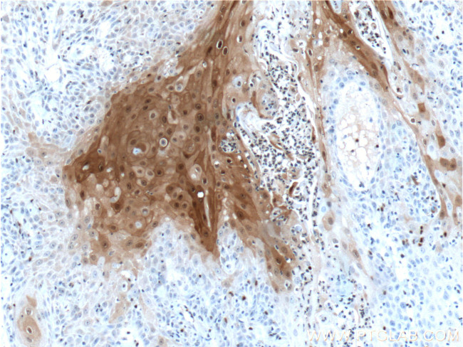 HOPX Antibody in Immunohistochemistry (Paraffin) (IHC (P))