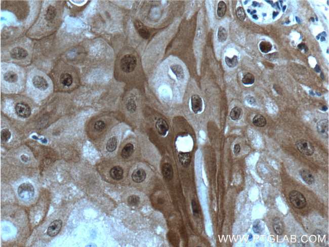 HOPX Antibody in Immunohistochemistry (Paraffin) (IHC (P))