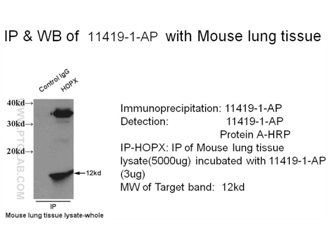 HOPX Antibody in Immunoprecipitation (IP)