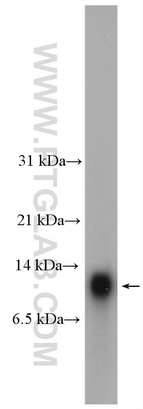 HOPX Antibody in Western Blot (WB)