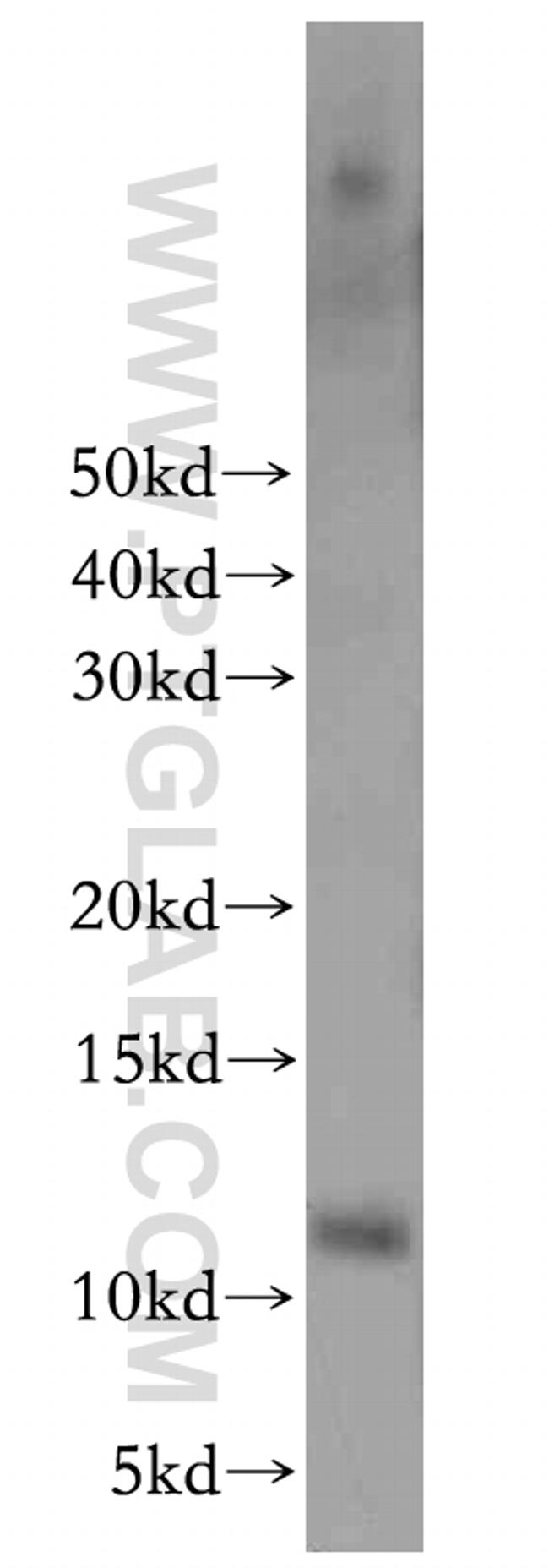 HOPX Antibody in Western Blot (WB)