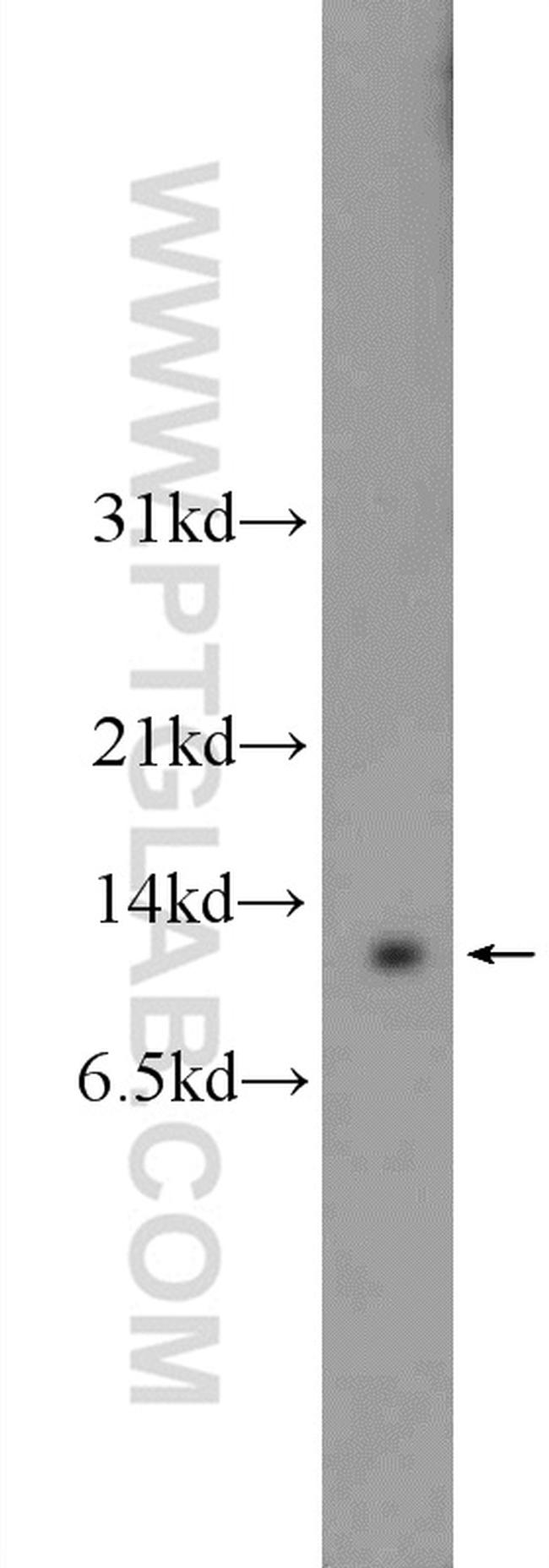 HOPX Antibody in Western Blot (WB)