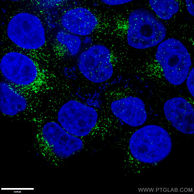 RAB9A Antibody in Immunocytochemistry (ICC/IF)