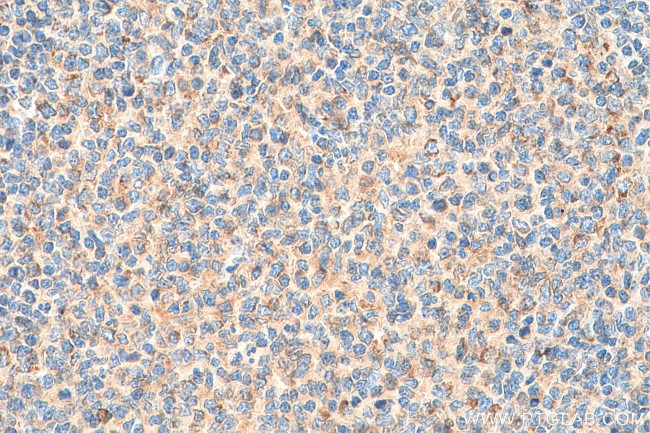 RAB9A Antibody in Immunohistochemistry (Paraffin) (IHC (P))