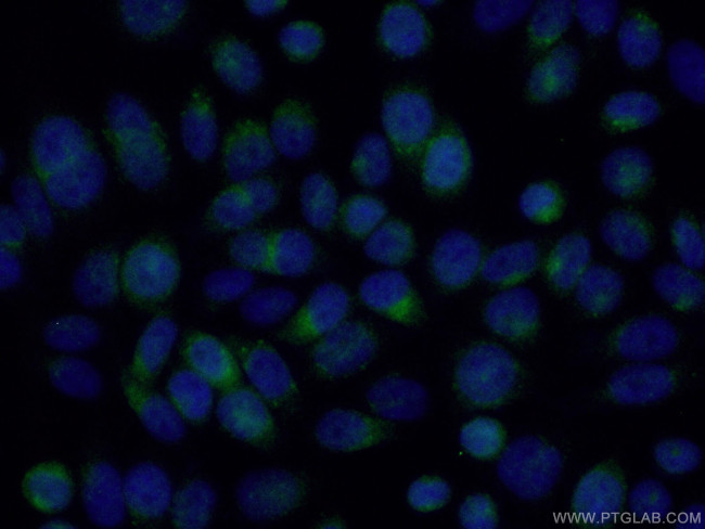 RAB9A Antibody in Immunocytochemistry (ICC/IF)