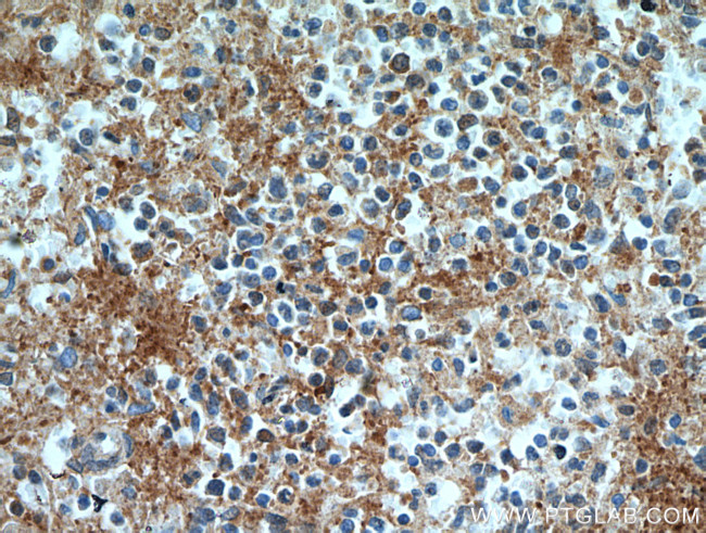 RAB9A Antibody in Immunohistochemistry (Paraffin) (IHC (P))