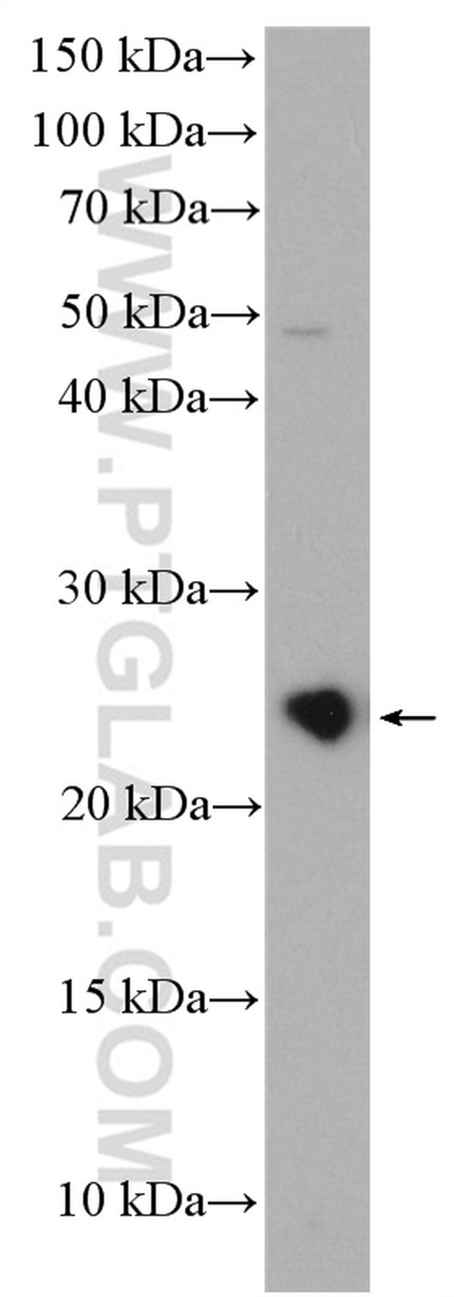 RAB9A Antibody in Western Blot (WB)