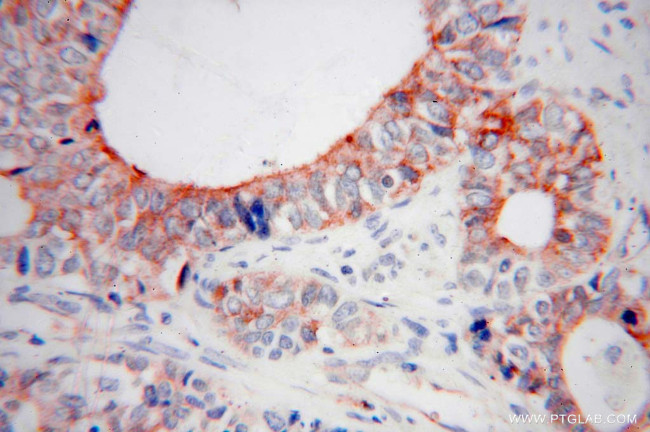 MARCKSL1 Antibody in Immunohistochemistry (Paraffin) (IHC (P))