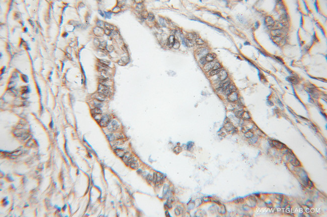 MARCKSL1 Antibody in Immunohistochemistry (Paraffin) (IHC (P))