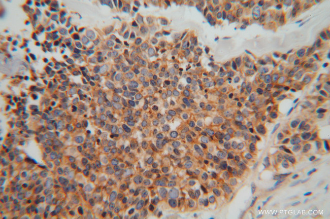 MARCKSL1 Antibody in Immunohistochemistry (Paraffin) (IHC (P))