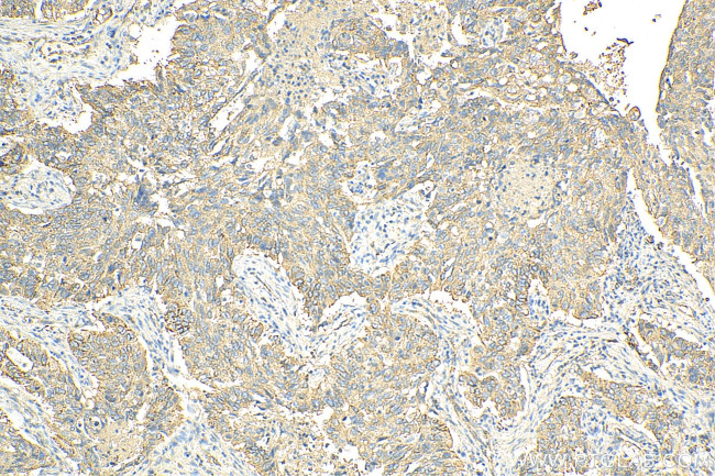 MARCKSL1 Antibody in Immunohistochemistry (Paraffin) (IHC (P))