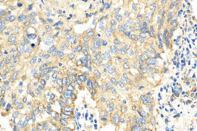 MARCKSL1 Antibody in Immunohistochemistry (Paraffin) (IHC (P))