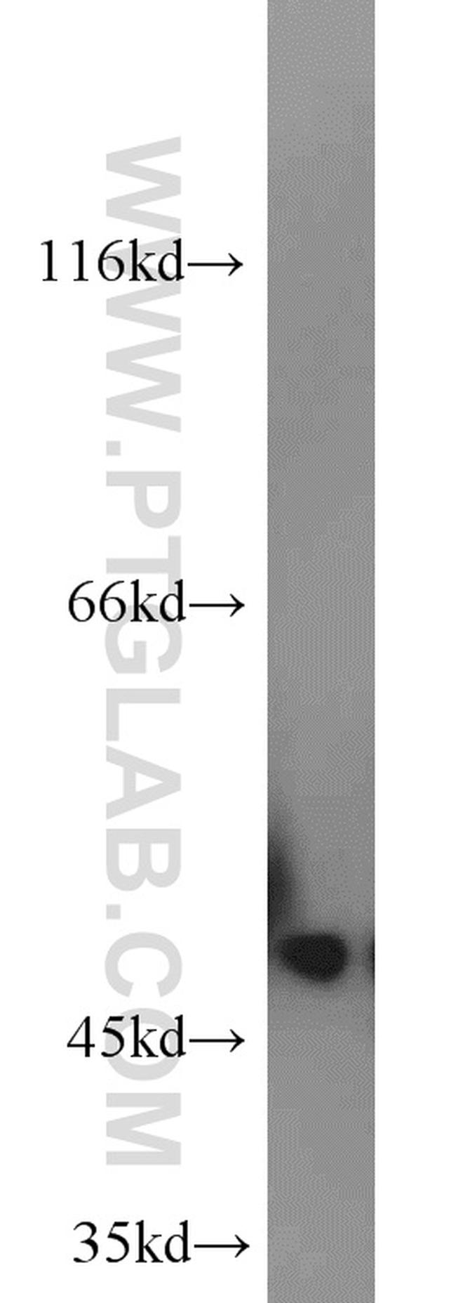 MARCKSL1 Antibody in Western Blot (WB)